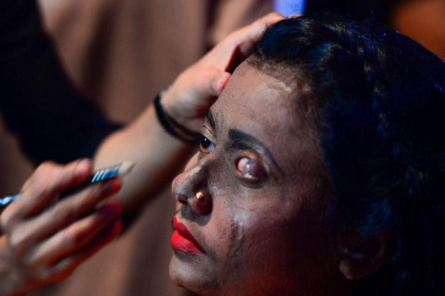 遭硫酸毀容女性走秀 重新定義美[組圖]