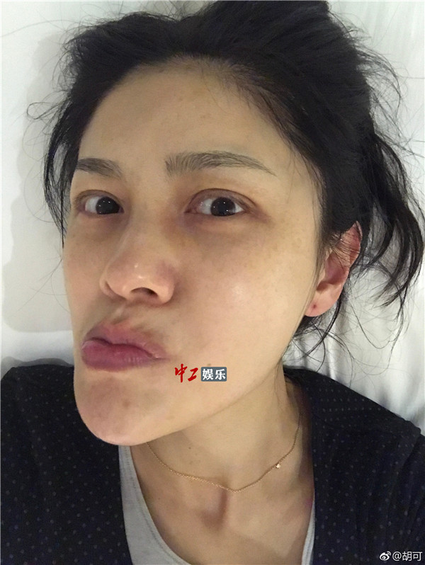 胡可曬素顏斗圖放飛自我 網友：沙溢快來出大事啦！