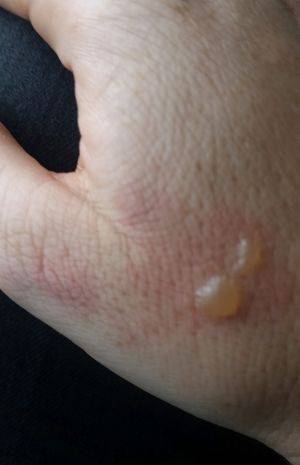 航班上耳機爆炸 冒出火星伴著一小撮火苗【圖】