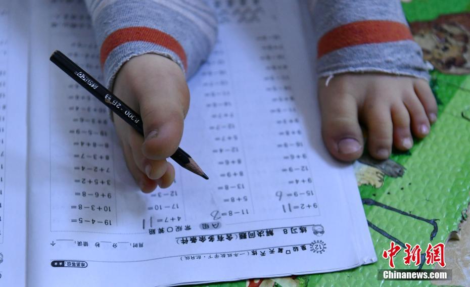 無臂男孩的快樂生活