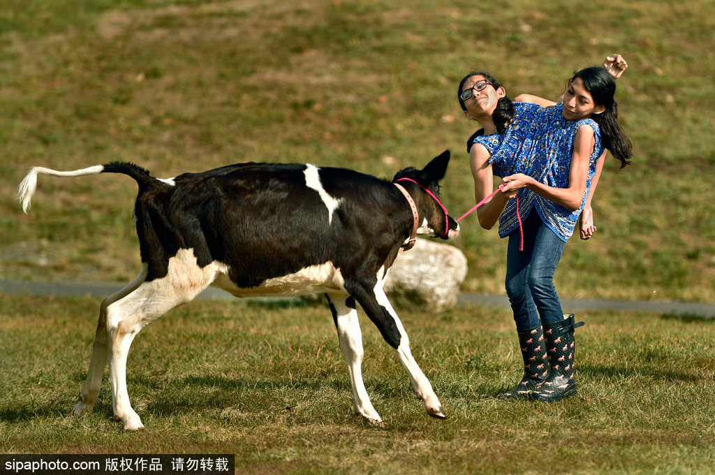 美國16歲連體姐妹拒做分離手術 她們的決定讓人無法理解