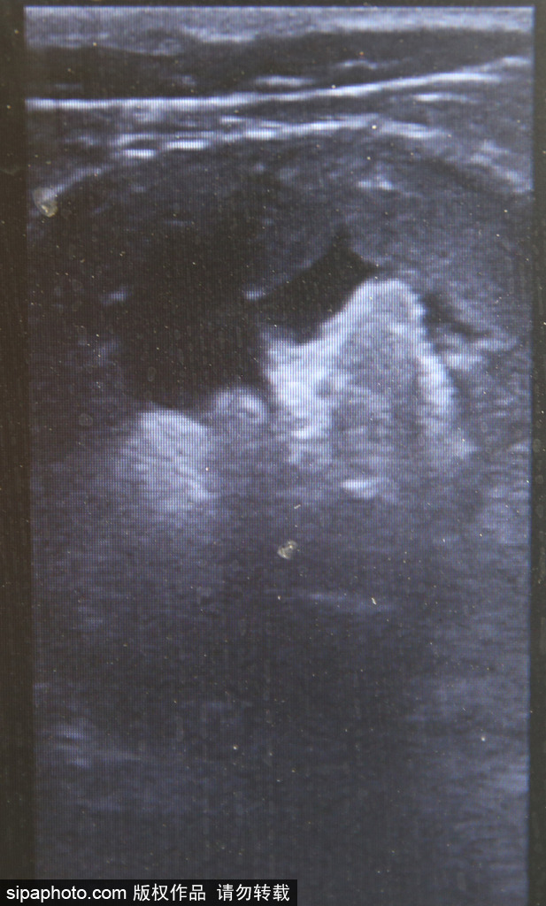 樹懶也有牙病？德國哈雷動物園樹懶接受牙醫治療